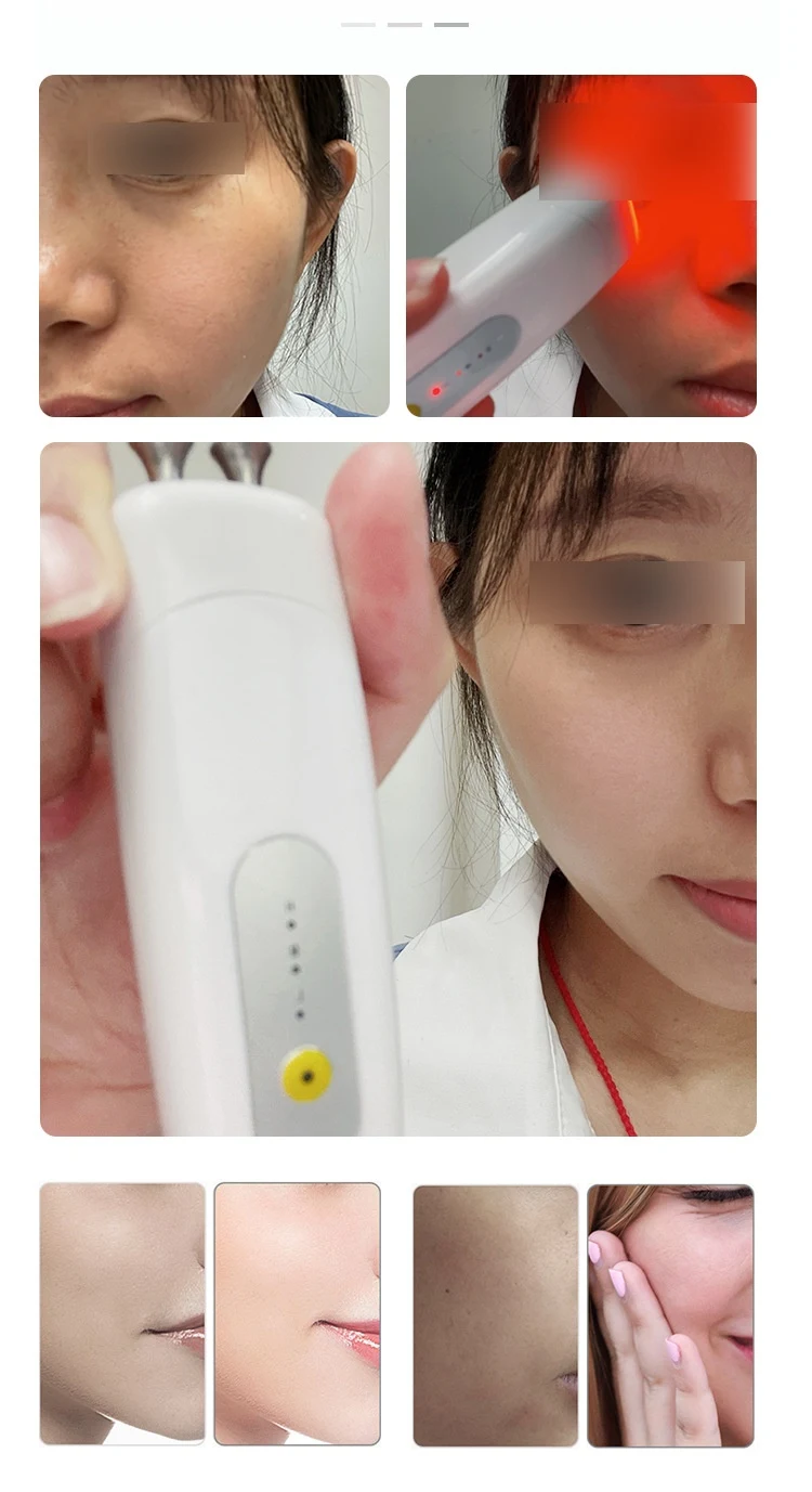 Massageador Elétrico Facial Rejuvenescedor para Olhos Lifting Stick Reduz Rugas e Bolsas Eleva a Pele Estimula Colágeno Anti-idade — foto 2