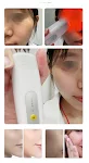 Massageador Elétrico Facial Rejuvenescedor para Olhos Lifting Stick Reduz Rugas e Bolsas Eleva a Pele Estimula Colágeno Anti-idade — foto 2