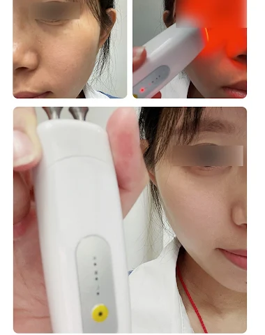 Image product - 1