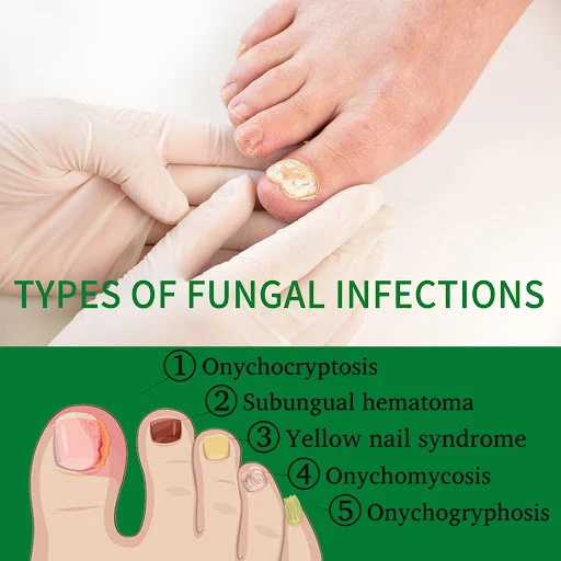 Title 9, Ginger Nail Care Solution for Soft Nails. Stren...