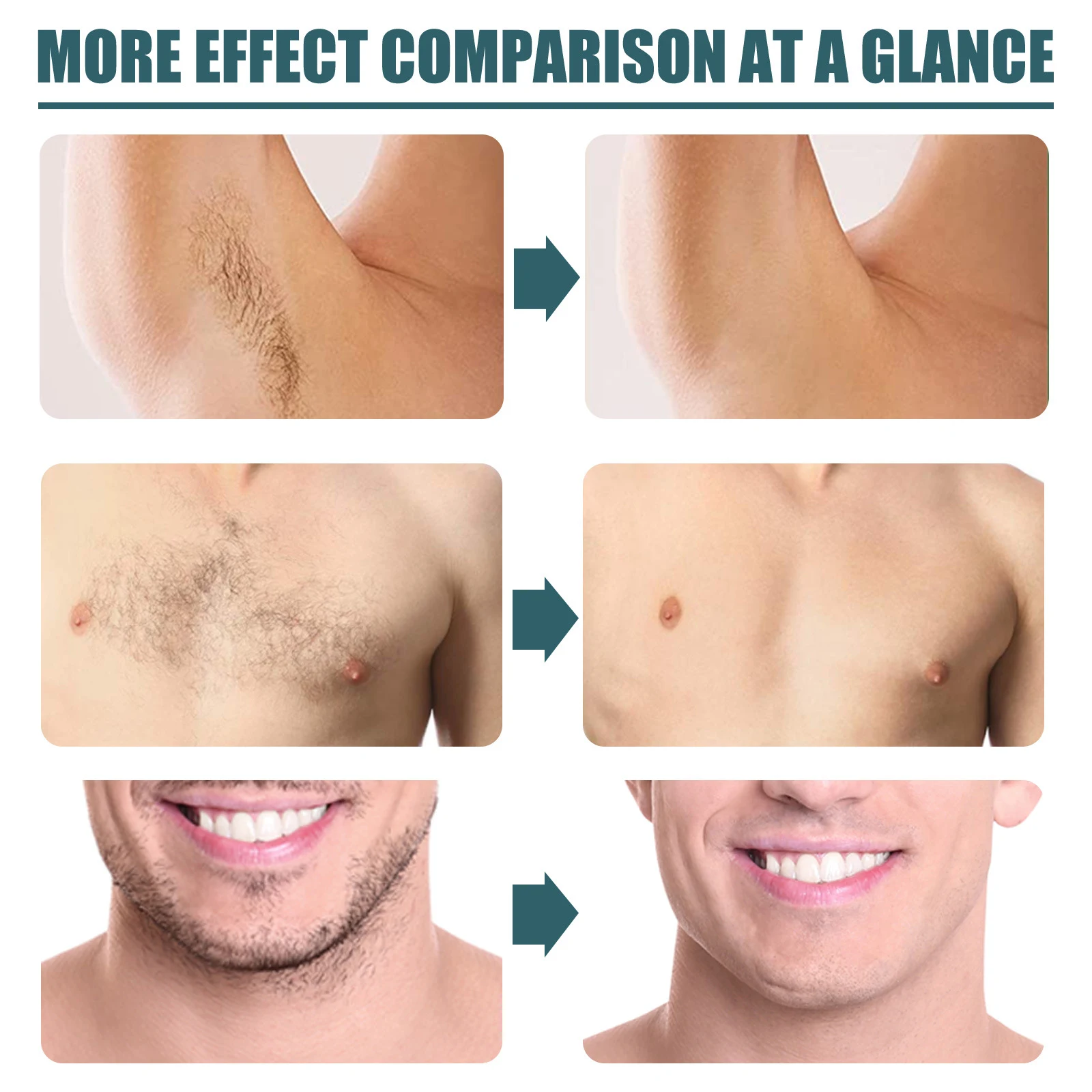 Creme depilatória masculina limpa e suave Remoção de pelos corporais indesejados de forma eficaz e delicada para uma pele macia e suave. — foto 1