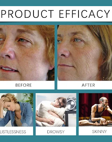 Image product - 2