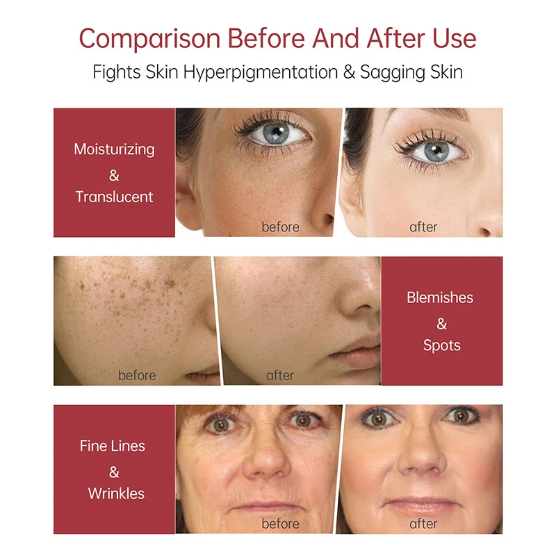 Original Peeling Essence — foto 11