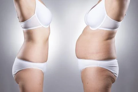 Parche Adelgazante para Ombligo Detox Abdomen con Imán Reduce Grasa y Desintoxica Fácilmente Pegatinas para el Vientre Planas — foto 8