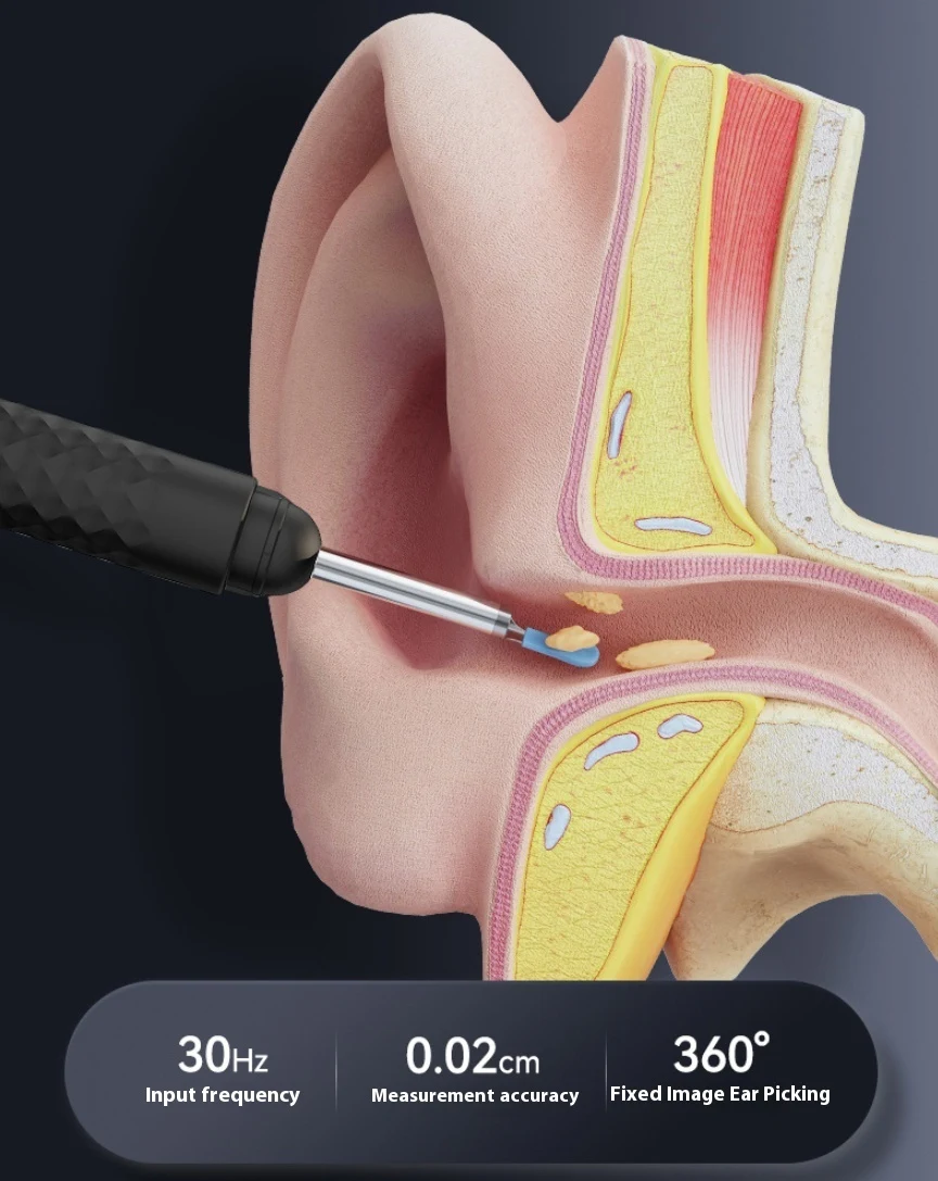 Title 7, Luminous Smart HD Visual Ear Pick