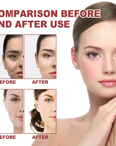 Image product - 3