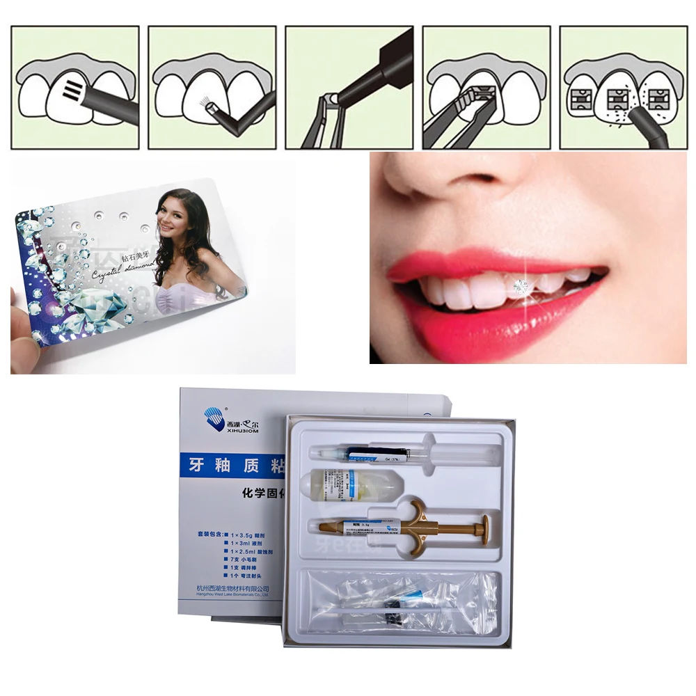 Adesivo per smalto ortodontico in resina fotopolimerizzabile. Fissaggio forte e preciso per brackets. Riduce i tempi e migliora l'estetica dentale. — foto 5