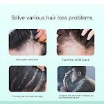 Strumento Terapeutico Induttivo a Micro-aghi per la Crescita dei Capelli del Cuoio Capelluto. Promuove la crescita dei capelli. — foto 6