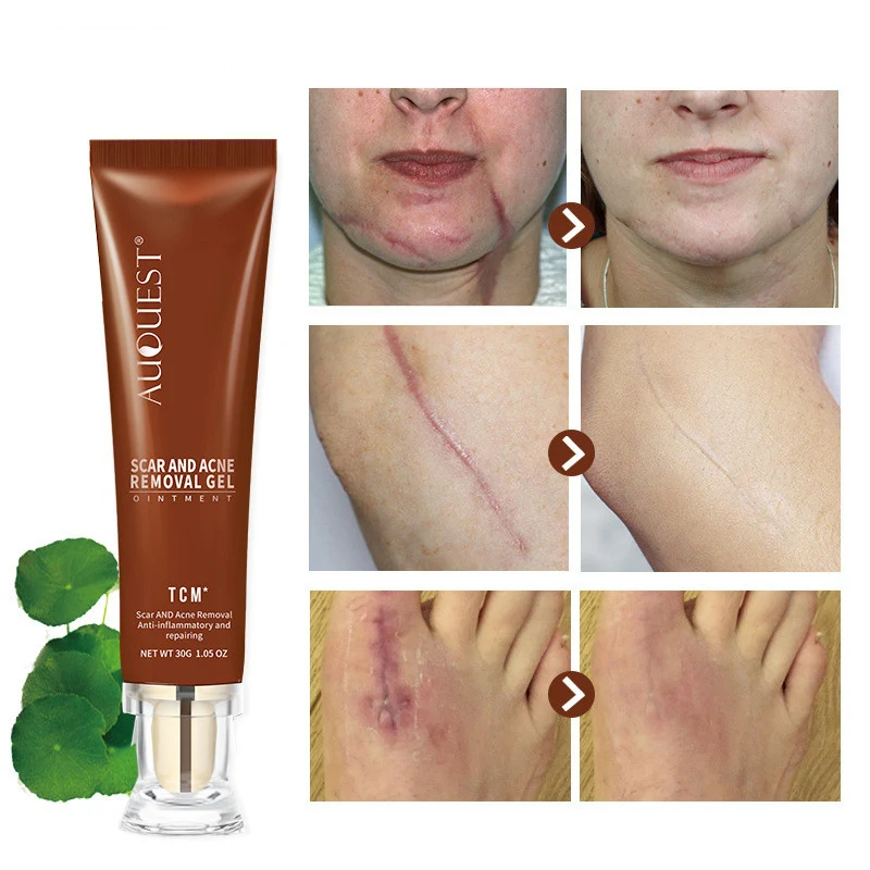 product image - 4