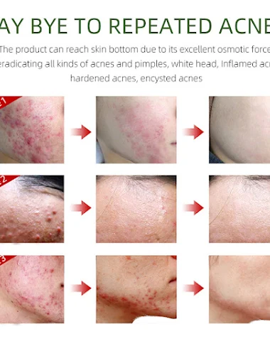 Image product - 1