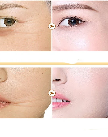 Image product - 3