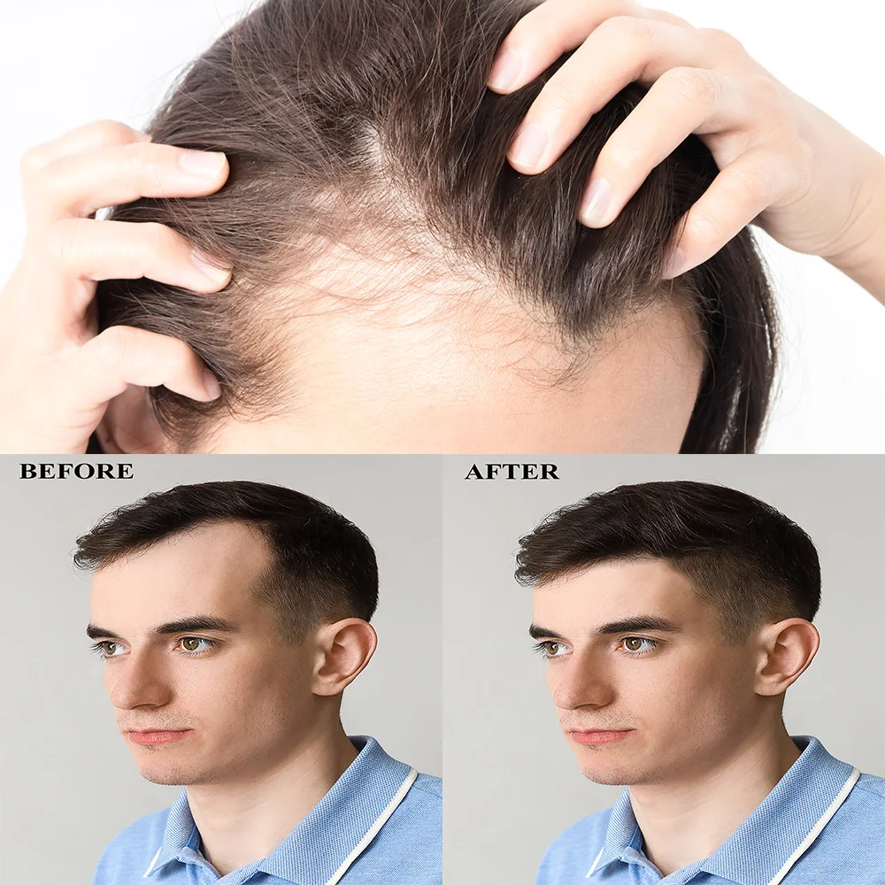 Title 2, Verdikkende Haarspray Hoofdhuidmassage Vochtinb...