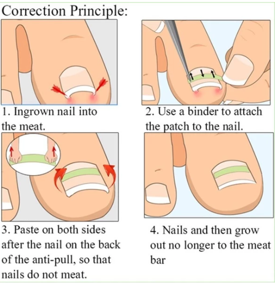 Easy to apply nail patches, stylish and durable designs for a perfect manicure in minutes. Get flawless nails effortless — photo 3