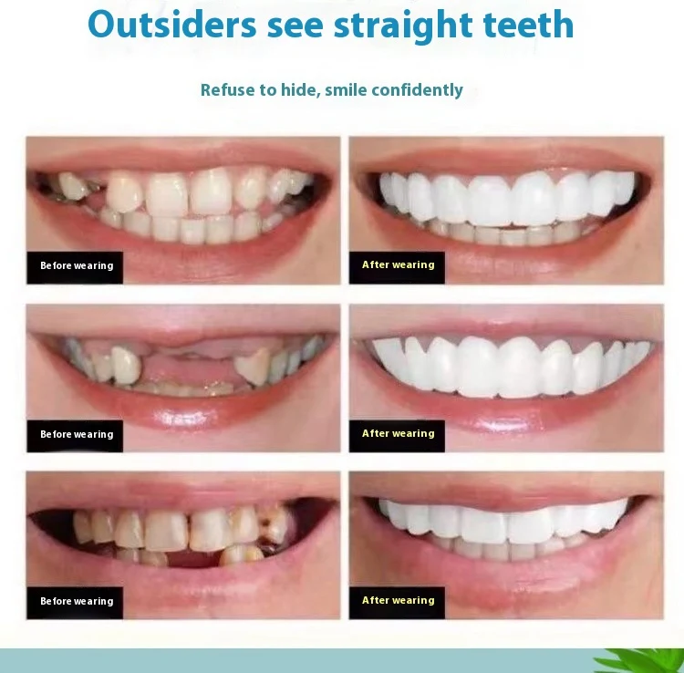 Simulation Teeth and Tooth Socket for Natural Eating. Enjoy a more realistic and comfortable eating experience with this — photo 8