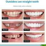Simulation Teeth and Tooth Socket for Natural Eating. Enjoy a more realistic and comfortable eating experience with this — photo 8