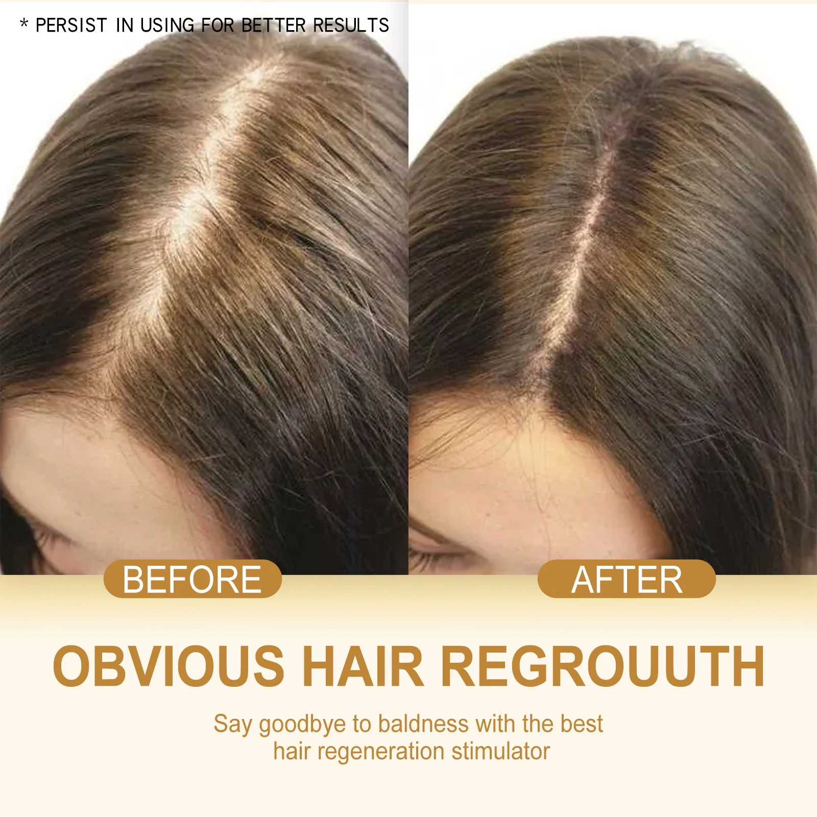 Shampoo condicionador de gengibre, limpeza suave e anticaída. Fortalece o cabelo, proporciona brilho e um couro cabeludo saudável. — foto 1