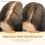 Shampoo condicionador de gengibre, limpeza suave e anticaída. Fortalece o cabelo, proporciona brilho e um couro cabeludo saudável. — foto 1
