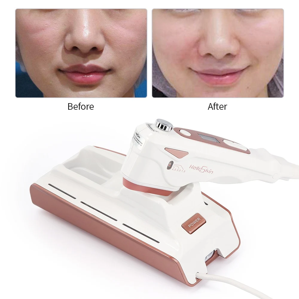 Title 8, Home V Face Lifting Ultrasonic Knife Anti-aging...