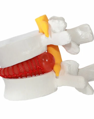 Image product - 2