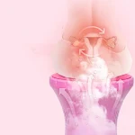 Home Moxibustion Gynecological Sitting Bath for feminine wellness. Provides relief from discomfort and supports overall — photo 6