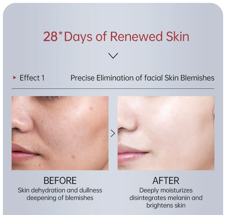 Aufhellende Anti-Aging-Hautcreme mit nährender Feuchtigkeitspflege. Repariert und erneuert die Haut, für einen strahlenden Teint. — foto 22
