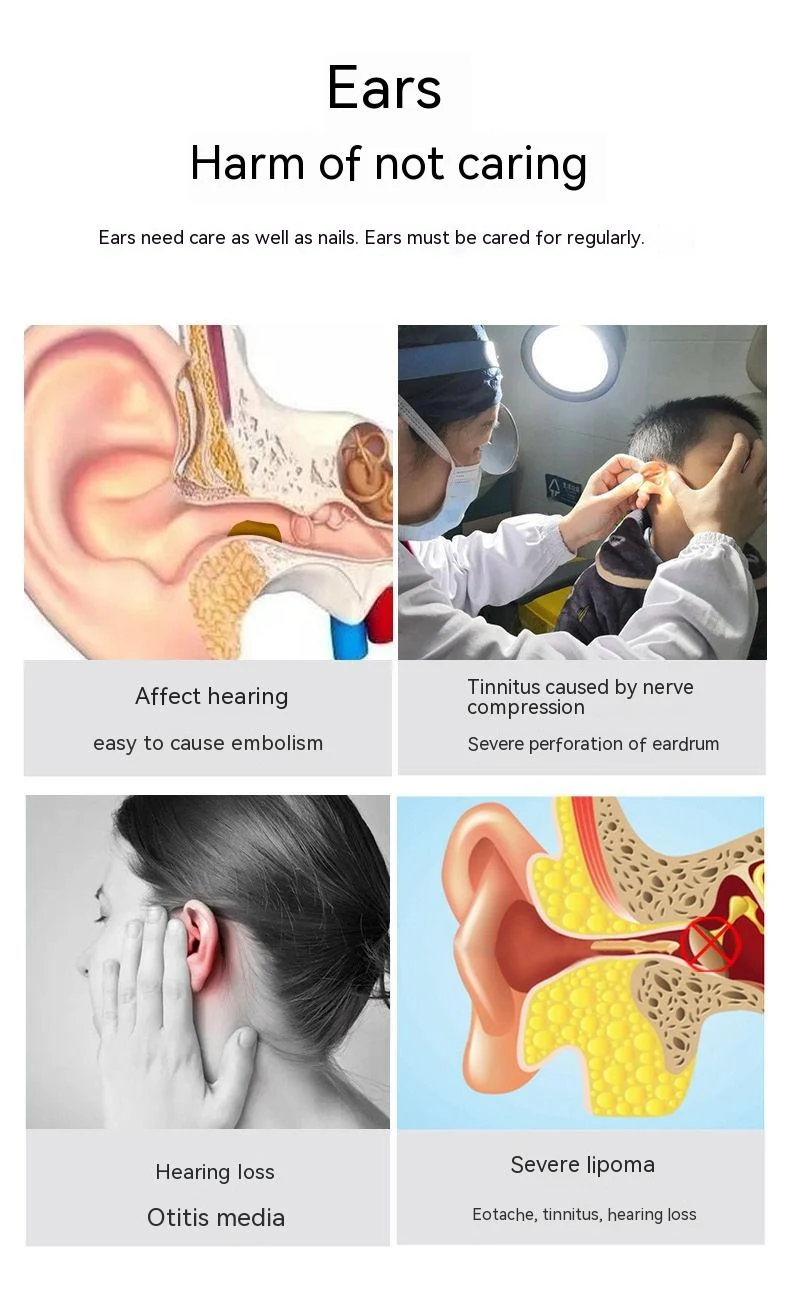 Title 4, Wireless Smart HD Endoscope Luminous Ear Pick E...