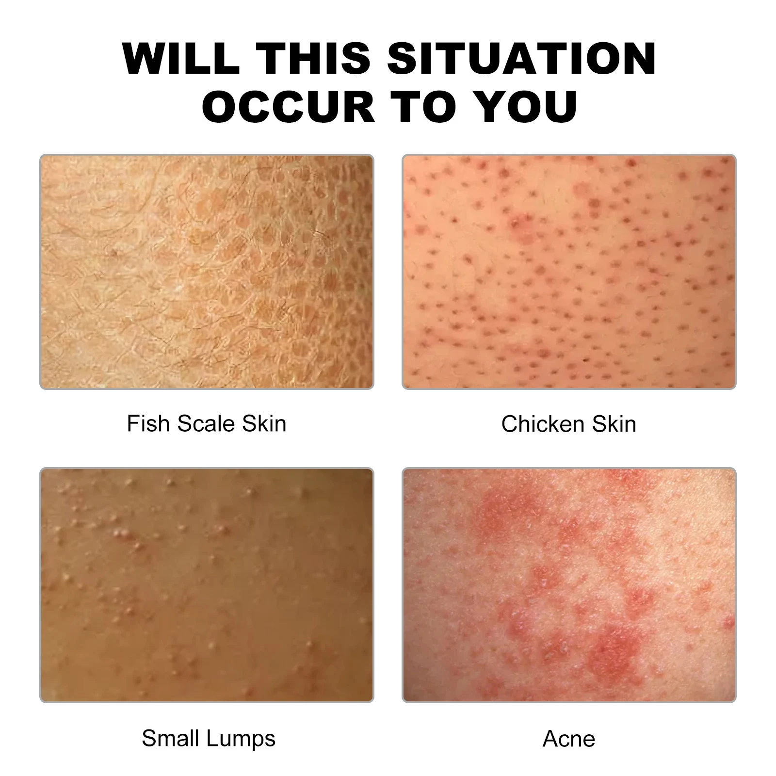 Title 2, Deep Cleansing Smooth Cream Cleanser for Acne P...
