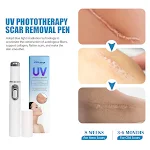 Caneta UV Clareadora de Cicatrizes Reparação Suave da Pele com Luz Reduz Cicatrizes Suaviza a Pele Tratamento Leve para Cicatrizes — foto 1
