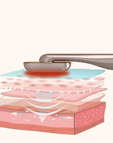 Image product - 0