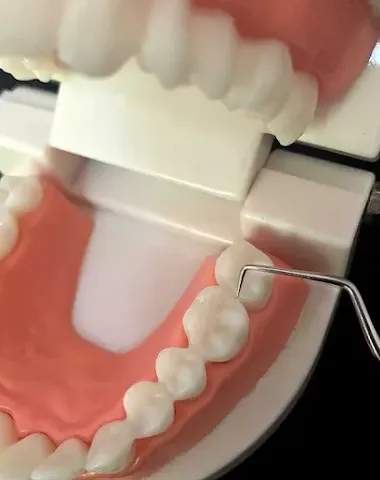 Image product - 1