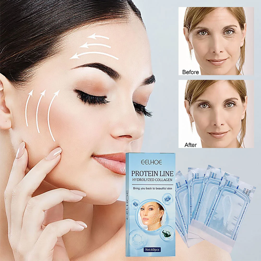 Protein Lifting Line Anti-Wrinkle Treatment for V-Shaped Face, Skin Lifting and Tightening, Reduces Fine Lines, Enhances — photo 5