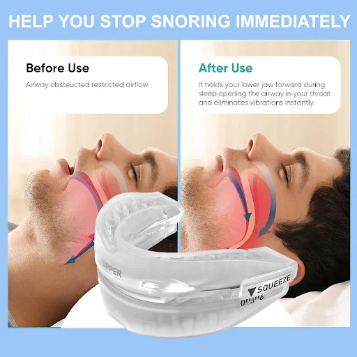 Title 8, Three-Gear Adjustable Hot Melt to Prevent Molar...
