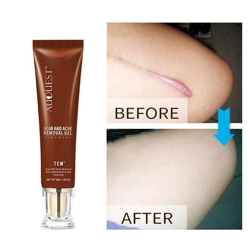 product image - 0