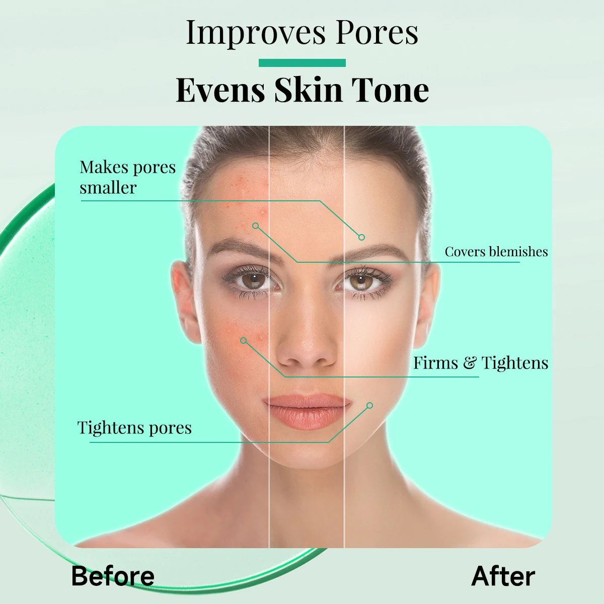 Líquido para remoção de acne com Tea Tree para mulheres. Dessalinização delicada. Pele limpa, sem imperfeições e radiante. Desfrute de uma pele perfeita. — foto 3