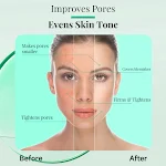 Líquido para remoção de acne com Tea Tree para mulheres. Dessalinização delicada. Pele limpa, sem imperfeições e radiante. Desfrute de uma pele perfeita. — foto 3