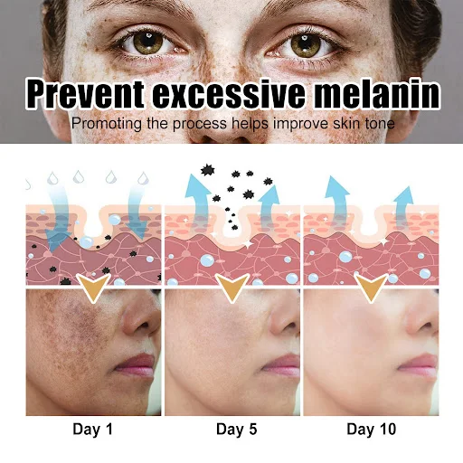 Title 5, Popravlja fleke na licu Hidratacija melaninon S...
