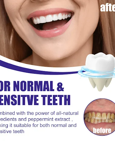 Image product - 3