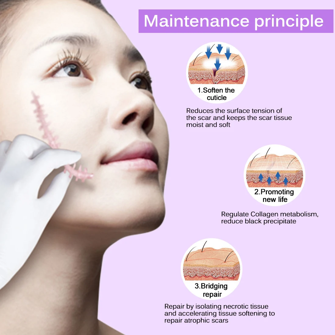 Crema Skin Rebound para cicatrices, sin cicatrices. Elimina cicatrices de acné, estrías y repara la piel facial. Crema para el rostro. — foto 11