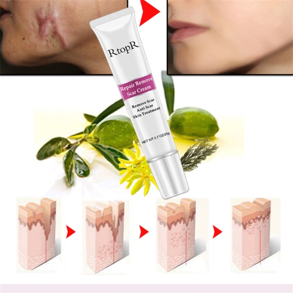 Creme reparador para a pele Hidrata, acalma e restaura a pele danificada. Alivia a secura, reduz a vermelhidão e promove uma pele saudável e radiante. — foto 3