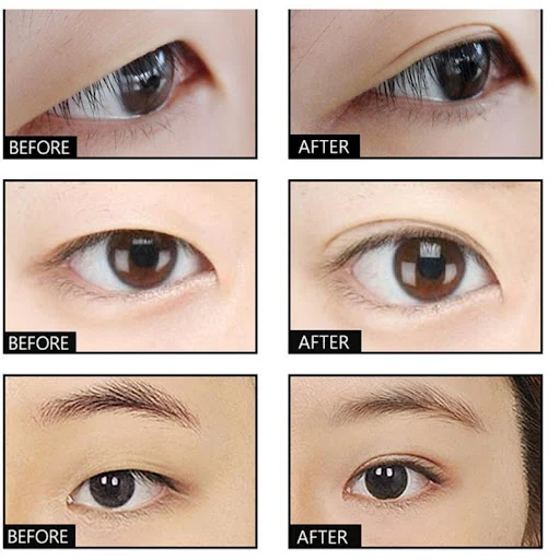 Title 4, Double Eyelid Cream for defined, captivating ey...