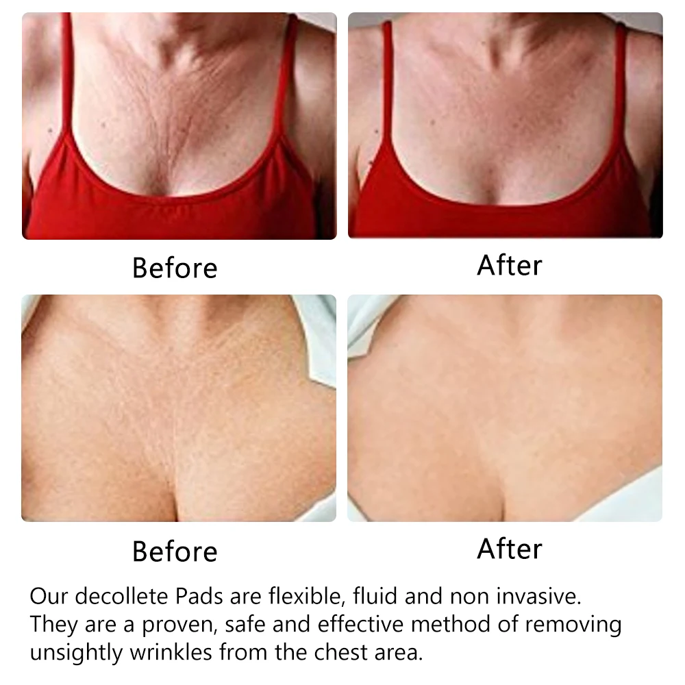 Almofada de Peito Antirrugas Reutilizável Invisível Anti-idade. Atenua rugas, suaviza a pele, uso confortável, efeito rejuvenescedor e duradouro. — foto 2