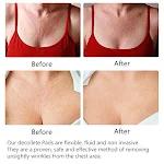 Almofada de Peito Antirrugas Reutilizável Invisível Anti-idade. Atenua rugas, suaviza a pele, uso confortável, efeito rejuvenescedor e duradouro. — foto 2