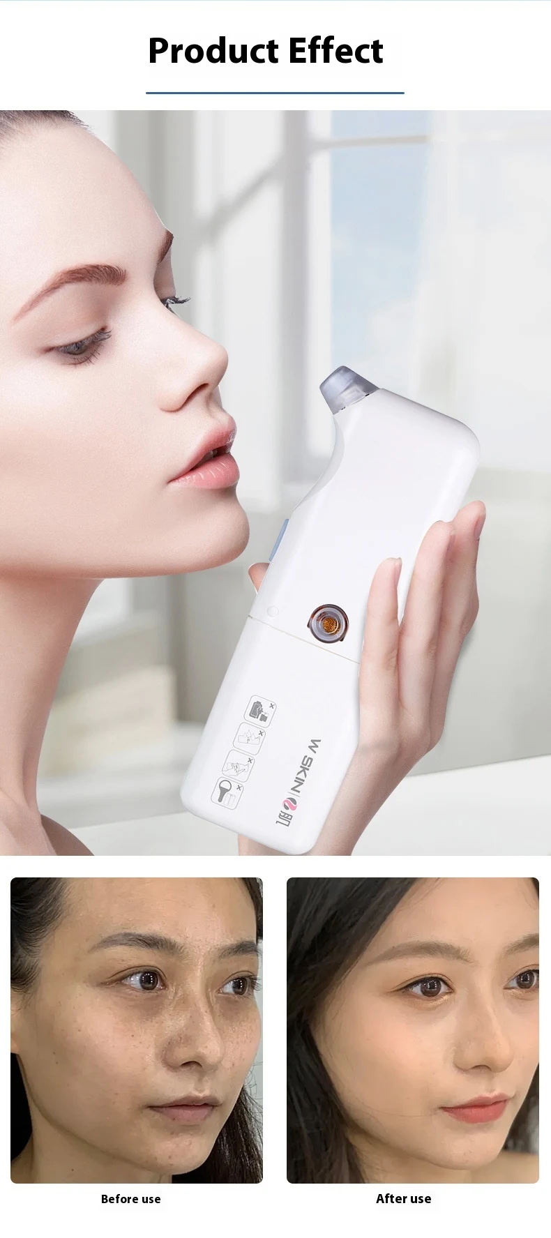 Title 7, Aparelho de limpeza facial com microbolhas domé...