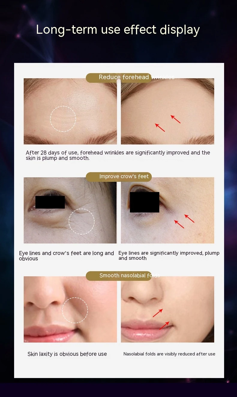 Aparelho de beleza Microcorrente Lifting Light Pattern para levantar a pele, reduzir rugas e melhorar o brilho natural, promovendo uma aparência rejuvenescida. — foto 3