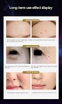Aparelho de beleza Microcorrente Lifting Light Pattern para levantar a pele, reduzir rugas e melhorar o brilho natural, promovendo uma aparência rejuvenescida. — foto 3
