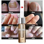 Líquido de reparação e manutenção para unhas Fortalece, repara e protege. Obtenha unhas saudáveis e bonitas com este tratamento essencial. — foto 2