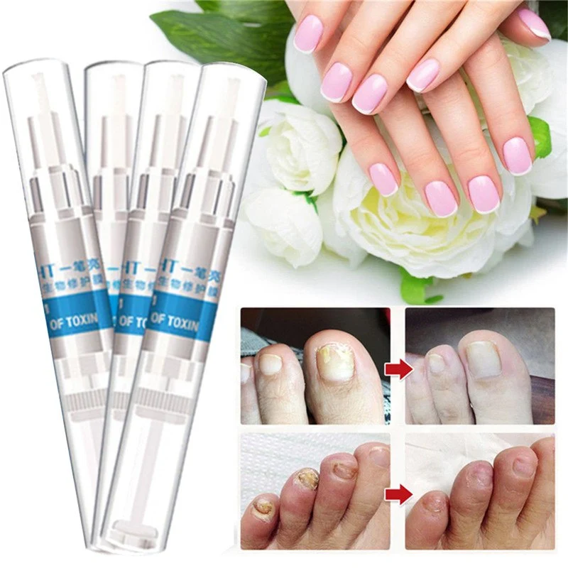 Caneta para cuidado das unhas das mãos e pés. Hidrata, fortalece e repara. Unhas saudáveis e bonitas com fácil aplicação. — foto 6