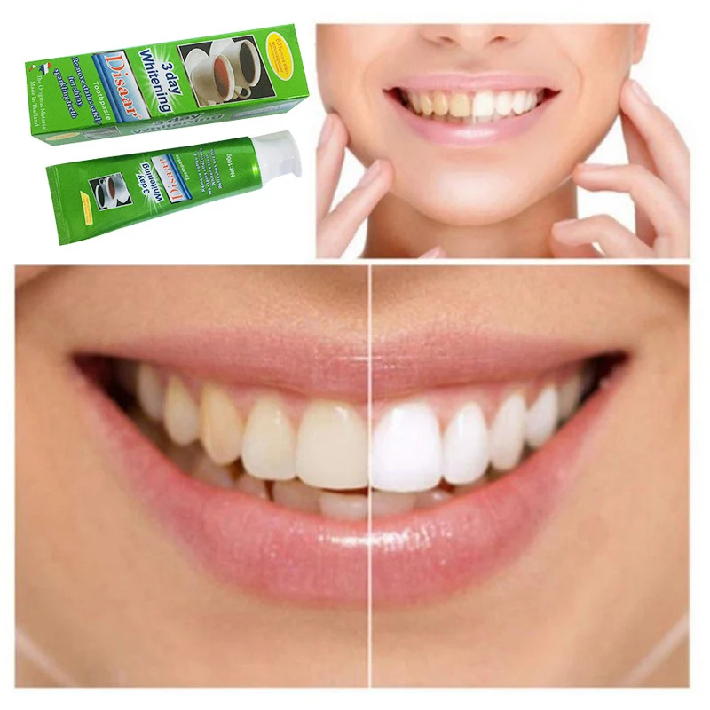 Toothpaste for tea stains Removes stains and restores natural whiteness. Whiter, brighter teeth, flawless smiles. Enjoy — photo 2