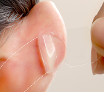 Adesivos Genie Ear Patch Magic Tape Suporte de Correção. Apoio discreto e eficaz para correção de orelhas, melhora a estética. — foto 8
