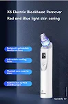 Aparelho de limpeza facial para cravos remove impurezas e melhora a pele com sucção eficaz, portátil e fácil de usar. Resultados visíveis e pele mais limpa. — foto 5
